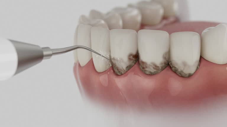 Reliable Wisdom Tooth Removal contractor in Robertson County County, TN by Dentist Open Now